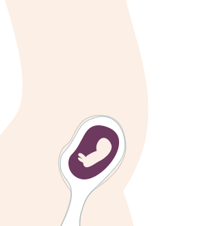11. SSW: Bei Risikoschwangerschaften können ab dieser Woche Untersuchungen zur Pränataldiagnostik gemacht werden. 11. SSW: Bei Risikoschwangerschaften können ab dieser Woche Untersuchungen zur Pränataldiagnostik gemacht werden.