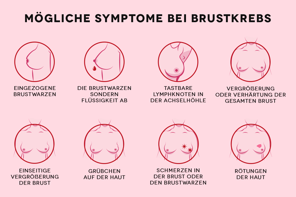 Symptome bei Brustkrebs Symptome bei Brustkrebs