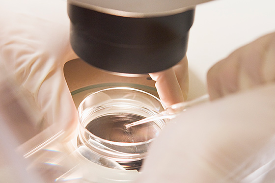 IVF IVF