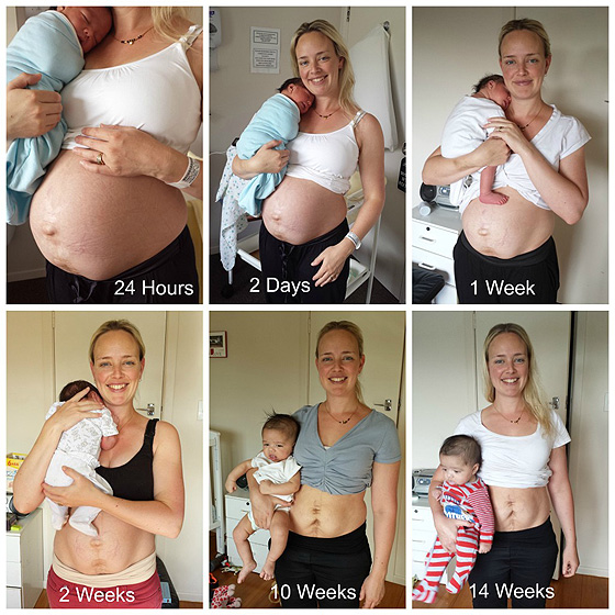Julie Bhosale: Postpartum body