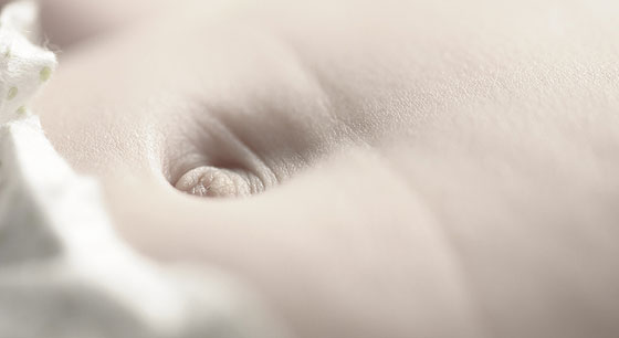 Nabelbruch: Babys Bauchnabel