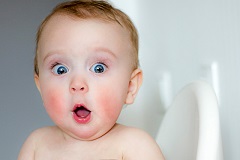 Rotze Wangen beim Baby
