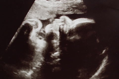 ungeborenes Baby in der 31 SSW