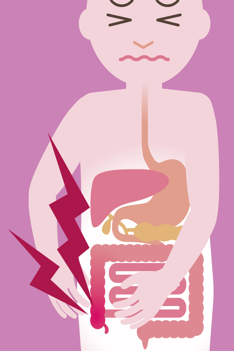 Appendizitis: Symptome