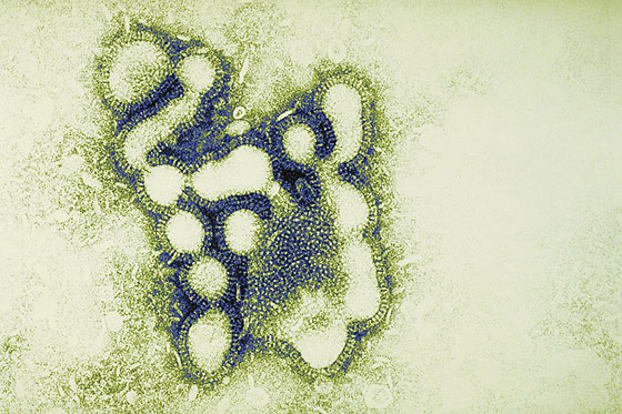 So sieht der Übeltäter aus: Influenza Virus unter dem Mikroskop
