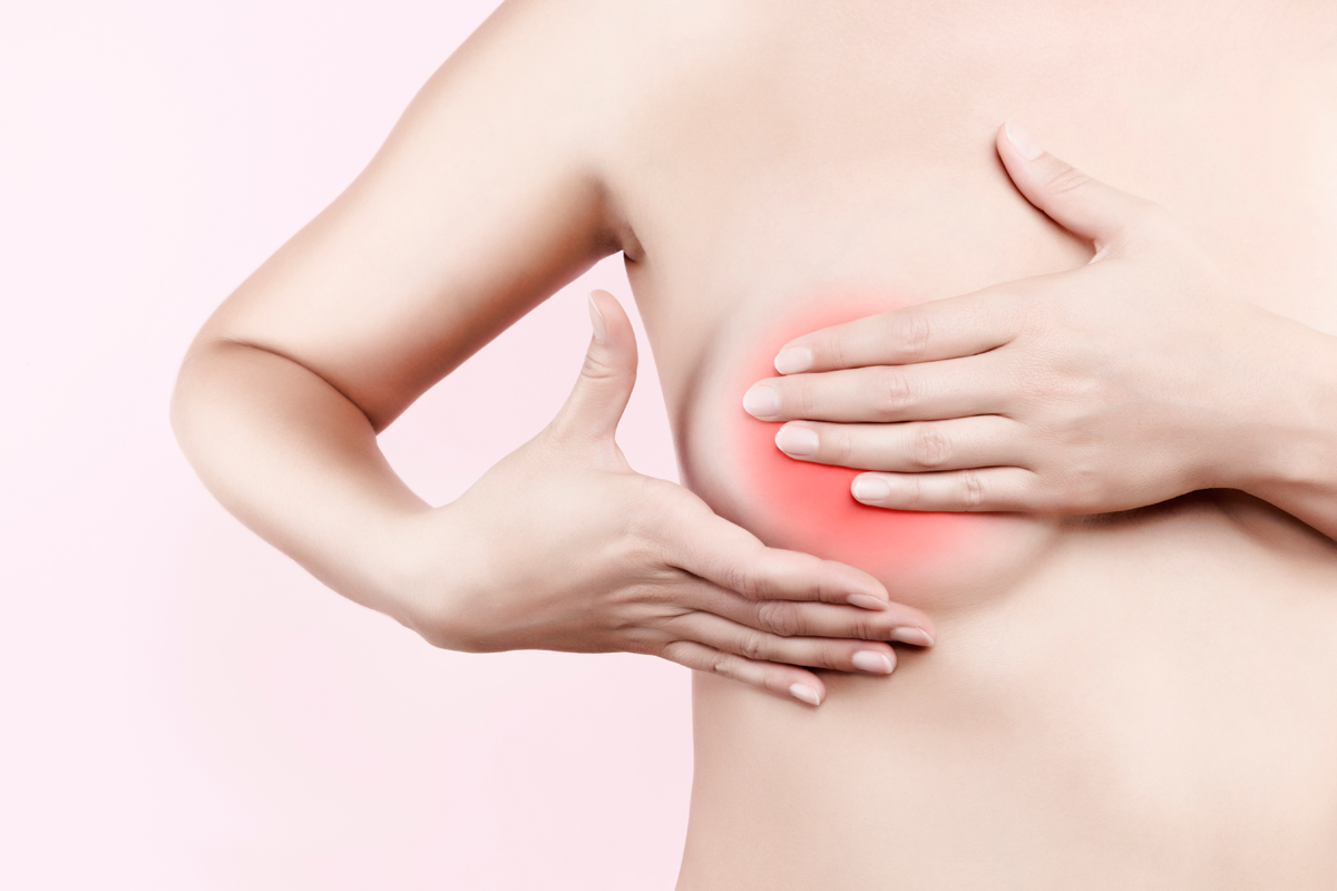 Mastitis: Frau mit Brustentzündung