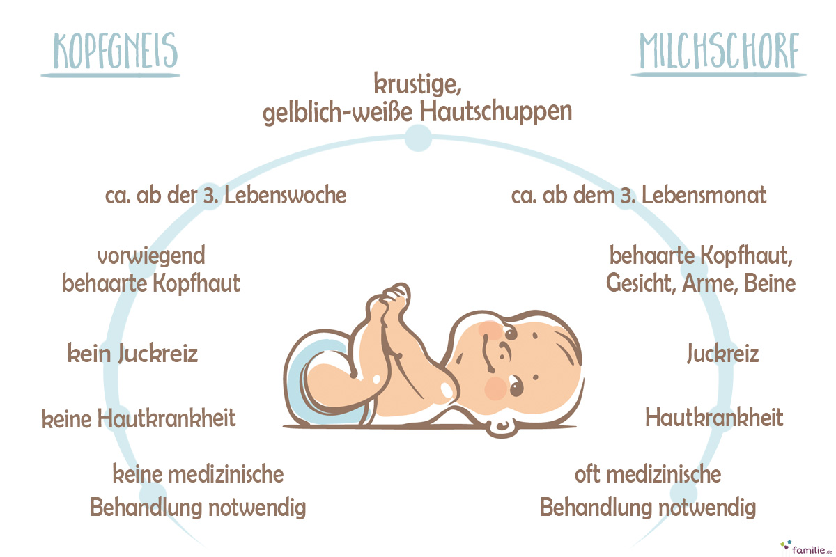 Grafik: Milschschorf oder Kopfgneis