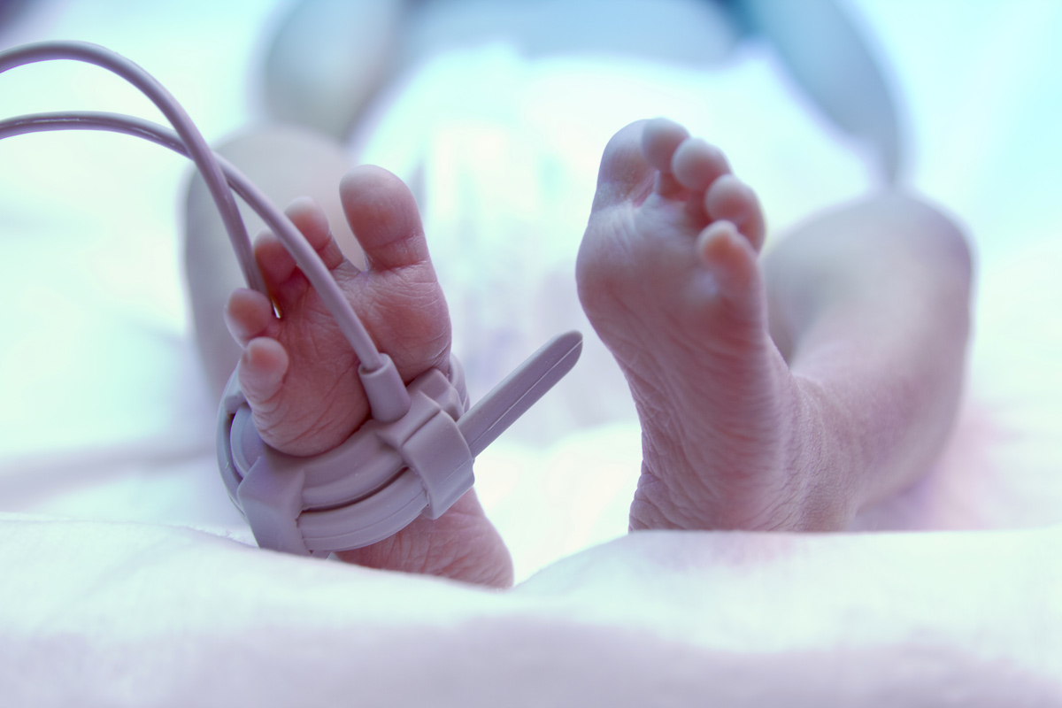 Neugeborenensepsis durch B-Streptokokken