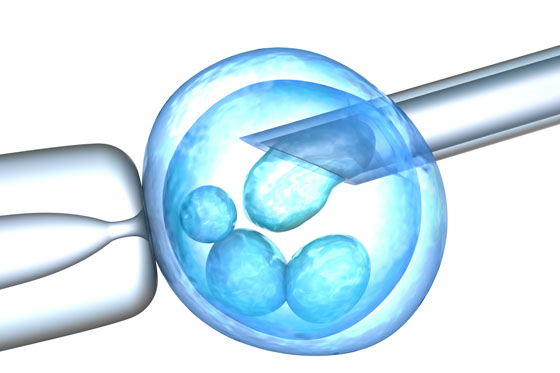 Präimplantationsdiagnostik: Rechtslage