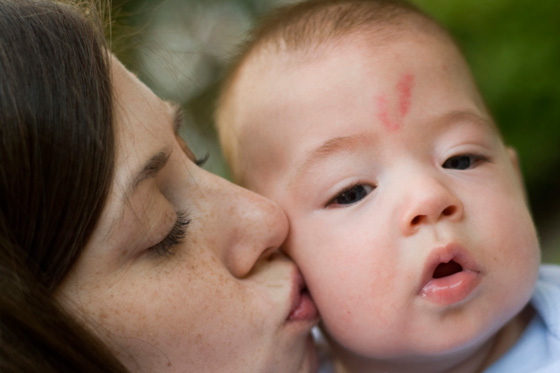 Baby mit Storchenbiss