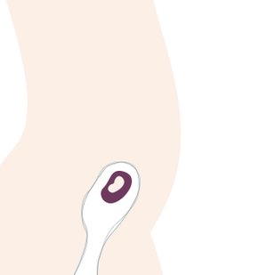 6. SSW: Die Hormonumstellung belastet den Körper