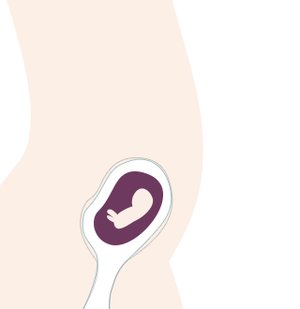 11. SSW: Bei Risikoschwangerschaften können ab dieser Woche Untersuchungen zur Pränataldiagnostik gemacht werden.