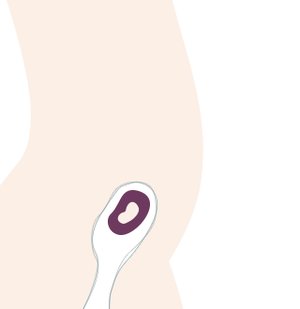 8. SSW: Stimmungsschwankungen sind jetzt typische Beschwerden